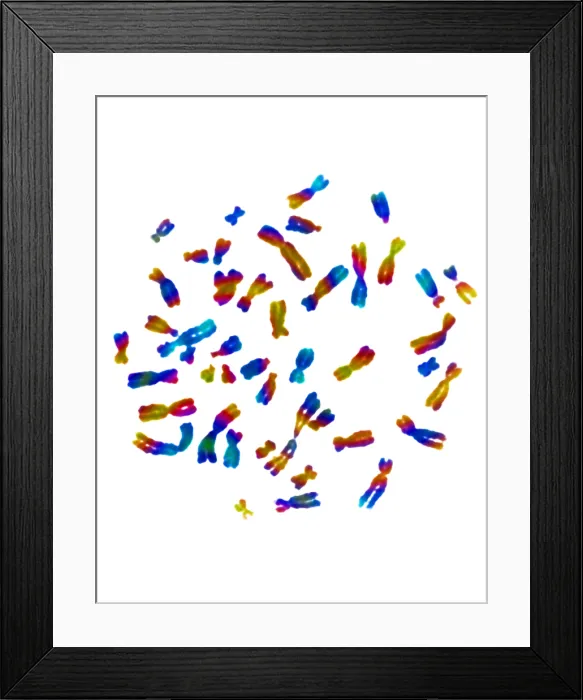 Framed Print : Karyotype, Normal Female Chromosomes Framed Print : Karyotype, Normal Female Chromosomes