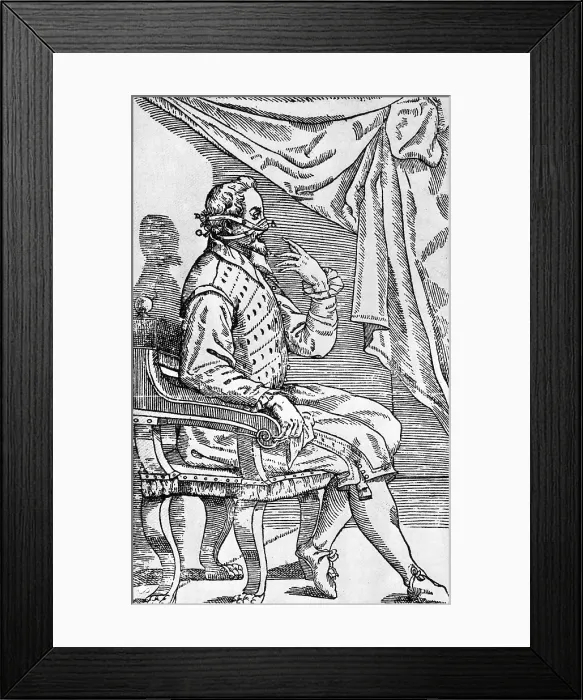 Framed Print : One of Tagliacozzi's Rhinoplasty Methods, 5 of 6