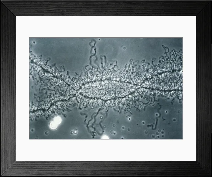 Framed Print : Lampbrush chromosome Framed Print : Lampbrush chromosome