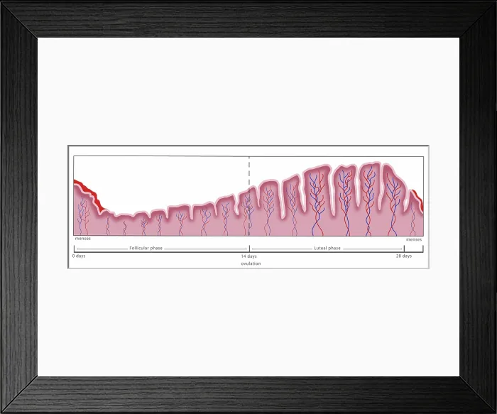 Framed Print : Uterine Lining, Menstruation, Illustration Framed Print : Uterine Lining, Menstruation, Illustration