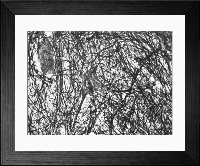 Framed Print : Motor Neuron, TEM