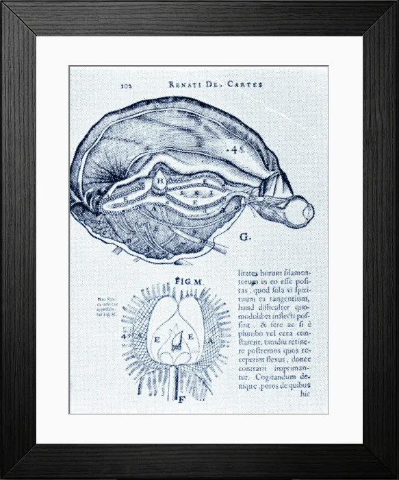 Framed Print : Brain and Pineal Gland Framed Print : Brain and Pineal Gland