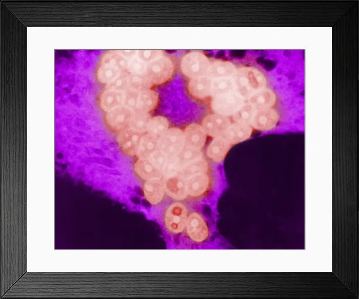 Framed Print : MeV, Measles Virus, TEM Framed Print : MeV, Measles Virus, TEM