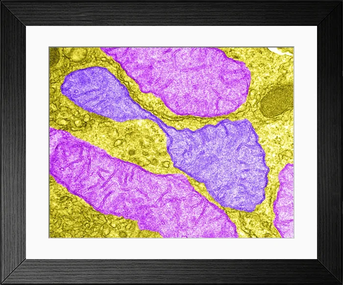 Framed Print : Hepatocyte, Dividing Mitochondrion, TEM