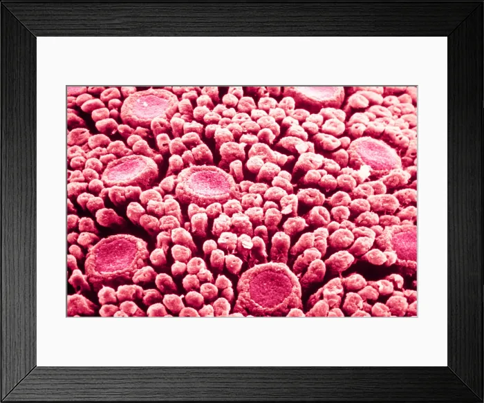 Framed Print : Tastebuds. Color enhanced scanning electron micrograph of taste buds on Framed Print : Tastebuds. Color enhanced scanning electron micrograph of taste buds on