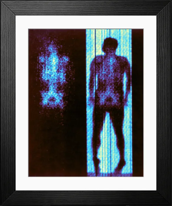 Framed Print : Distribution of Red-Cell-Forming Tissue Framed Print : Distribution of Red-Cell-Forming Tissue