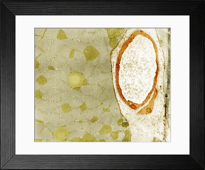 Framed Print : Cat Soleus Muscle, TEM