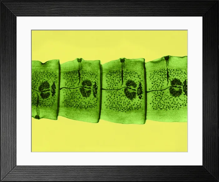 Framed Print : Dog Tapeworm under a microscope