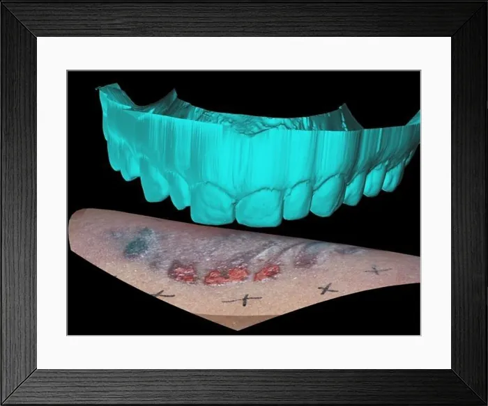 Framed Print : Computer Reconstruction of Bite Mark