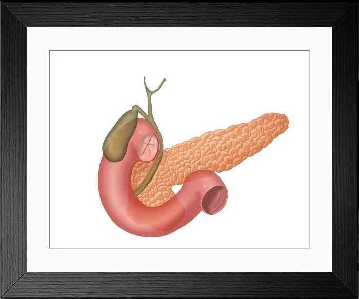 Framed Print : Anatomy of Biliary System
