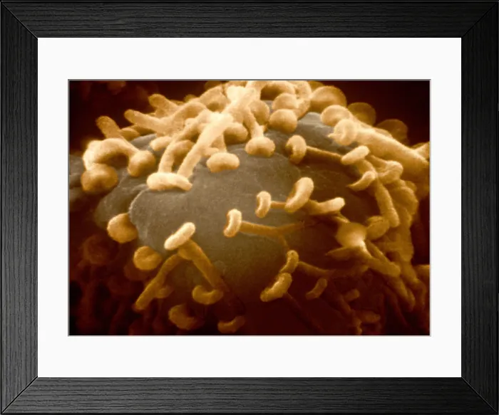 Framed Print : Motor Nerve, Synapses, under a microscope (SEM) Framed Print : Motor Nerve, Synapses, under a microscope (SEM)