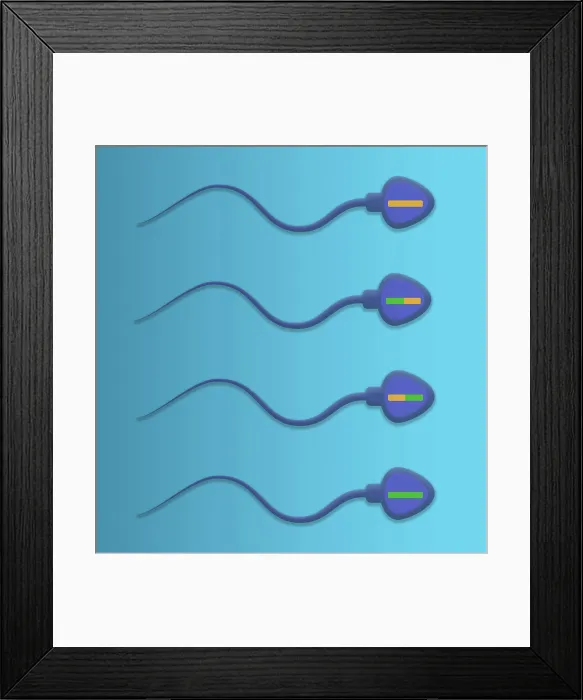 Framed Print : Genetic Recombination is the crossover of genetic material between chromosomes during spermatogenesis, microbiology Framed Print : Genetic Recombination is the crossover of genetic material between chromosomes during spermatogenesis, microbiology