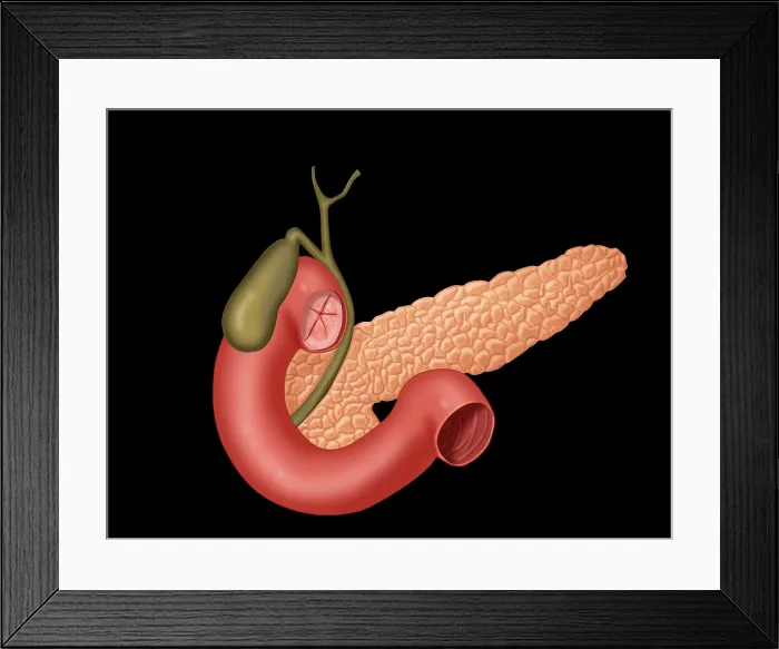 Framed Print : Anatomy of Biliary System Framed Print : Anatomy of Biliary System