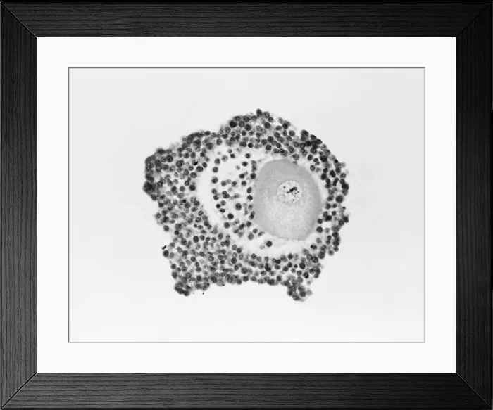 Framed Print : Ovarian egg