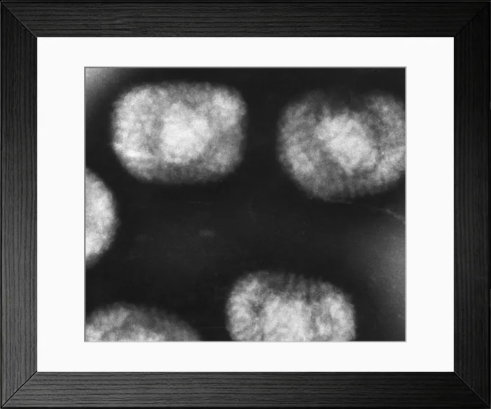 Framed Print : Vaccinia Virus, Eradicated Smallpox, TEM