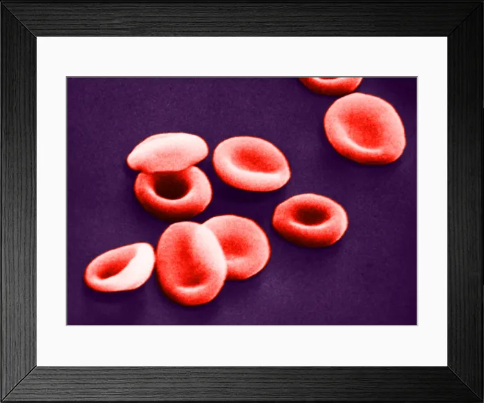 Framed Print : Red Blood Cells, under a microscope (SEM) Framed Print : Red Blood Cells, under a microscope (SEM)