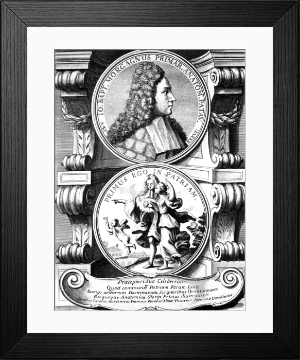 Framed Print : Giovanni Morgagni, Italian Anatomist Framed Print : Giovanni Morgagni, Italian Anatomist