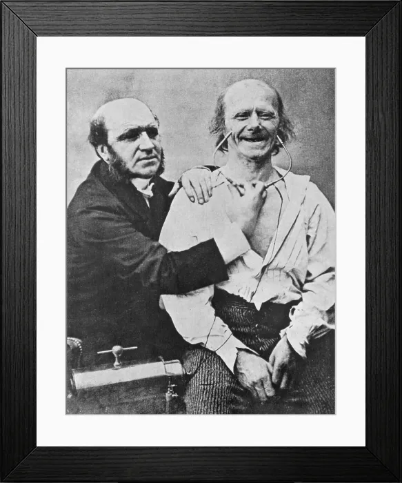 Framed Print : Duchenne Studying Physiognomy Framed Print : Duchenne Studying Physiognomy