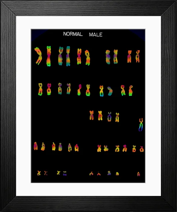 Framed Print : Karyotype, Normal Male Chromosomes Framed Print : Karyotype, Normal Male Chromosomes