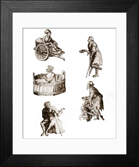 Framed Print : People With Leprosy Framed Print : People With Leprosy