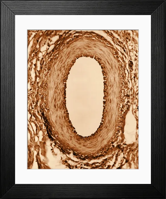 Framed Print : Circulatory System, Healthy Artery, TEM