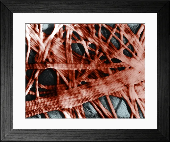 Framed Print : Integumentary System, Subcutaneous Tissue, TEM Framed Print : Integumentary System, Subcutaneous Tissue, TEM