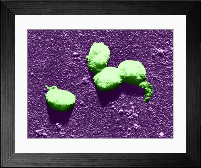 Framed Print : Vaccinia Virus, Eradicated Smallpox, TEM