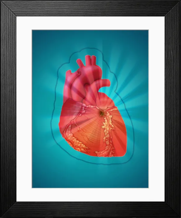 Framed Print : Heart Attack, Conceptual Illustration Framed Print : Heart Attack, Conceptual Illustration