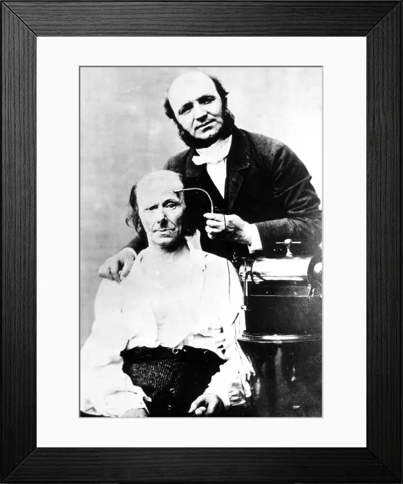 Framed Print : G.B.A. Duchenne Performs Electrotherapy, 1861