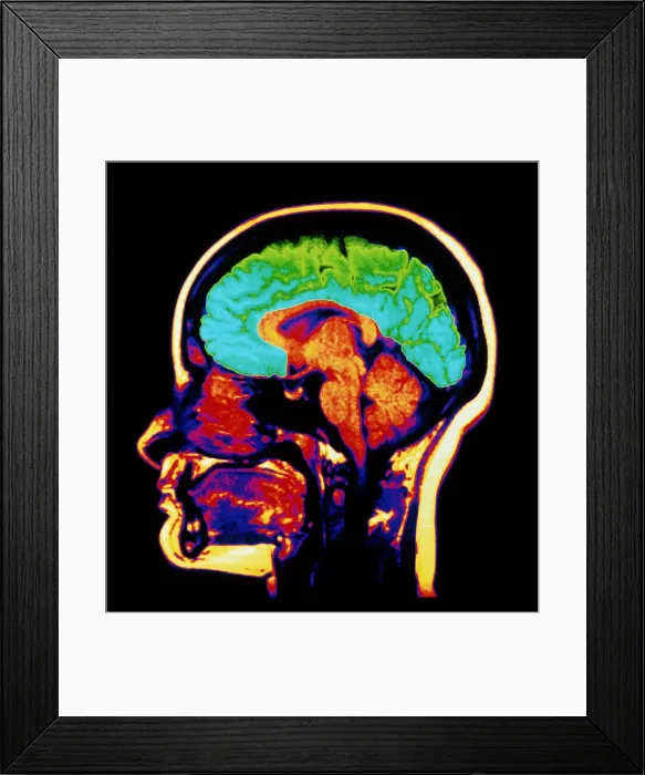 Framed Print : MRI brain scan