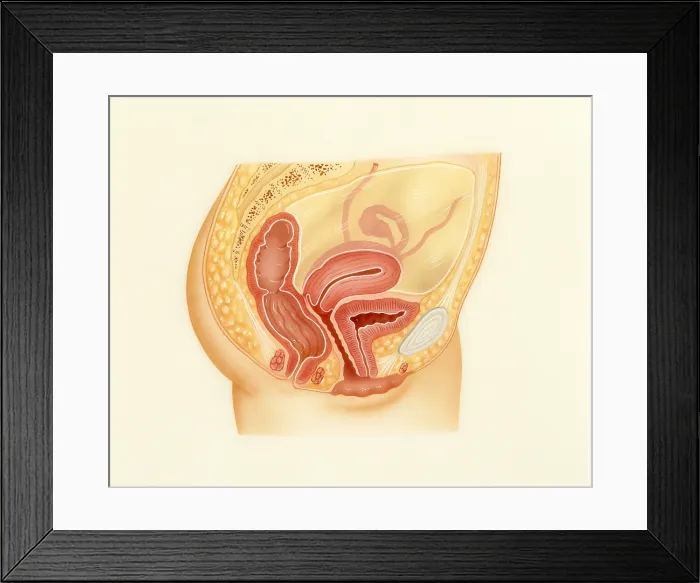 Framed Print : Female pelvic area Framed Print : Female pelvic area