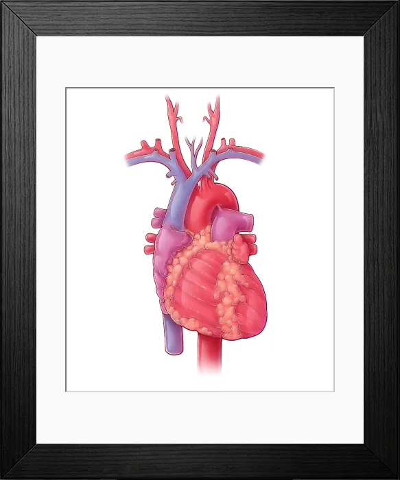 Framed Print : Heart, Illustration Framed Print : Heart, Illustration