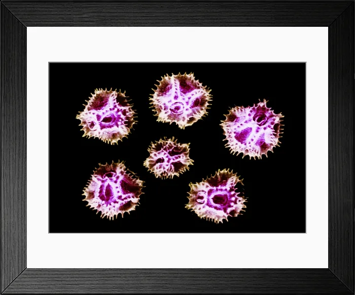 Framed Print : Chicory Pollen Grains