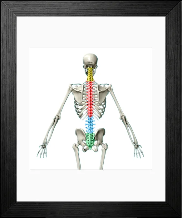 Framed Print : Vertebral Column, Illustration Framed Print : Vertebral Column, Illustration