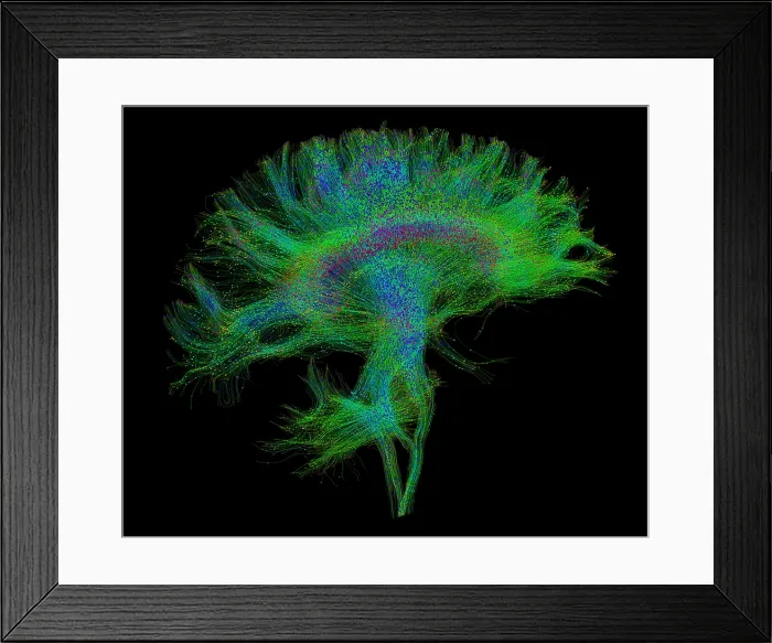 Framed Print : Brain, Fiber Tractography Image