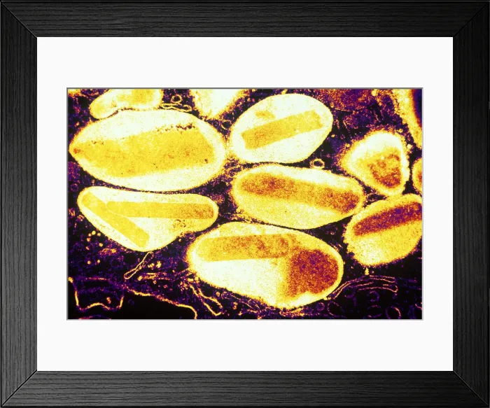 Framed Print : White Blood Cells Framed Print : White Blood Cells
