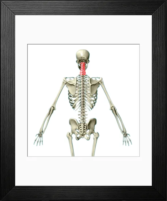 Framed Print : Cervical Vertebrae, Illustration Framed Print : Cervical Vertebrae, Illustration