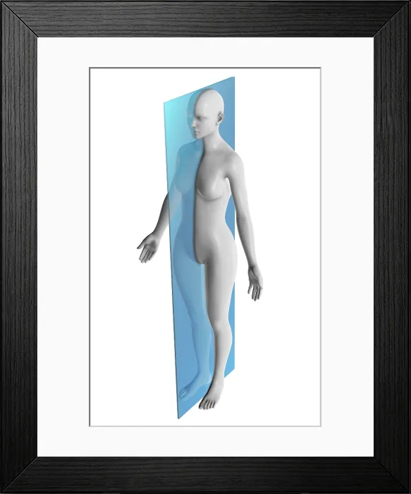 Framed Print : Sagittal Plane Framed Print : Sagittal Plane