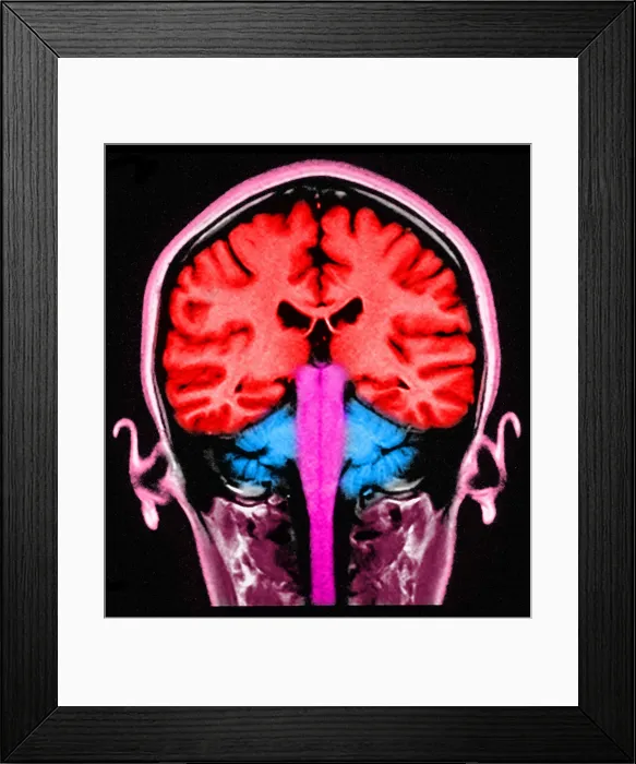 Framed Print : Brain, Sagittal View, MRI Framed Print : Brain, Sagittal View, MRI