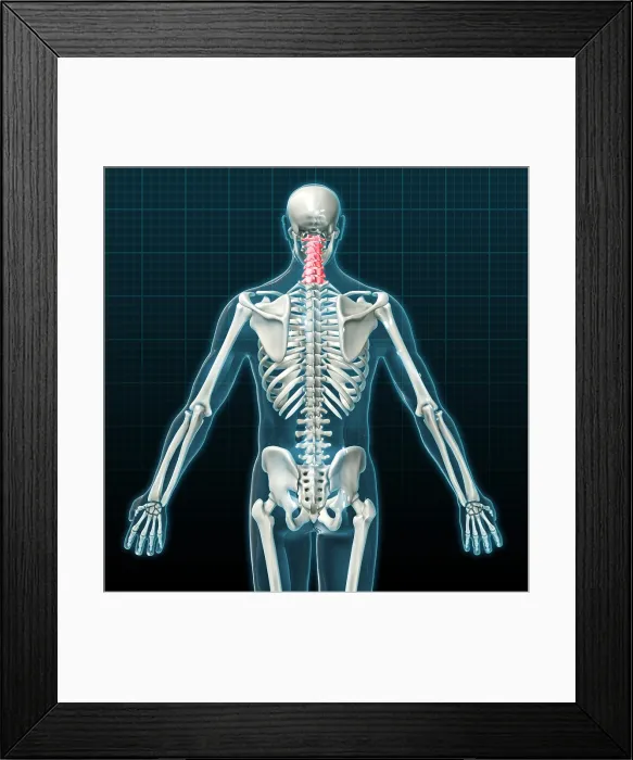 Framed Print : Cervical Vertebrae, Illustration