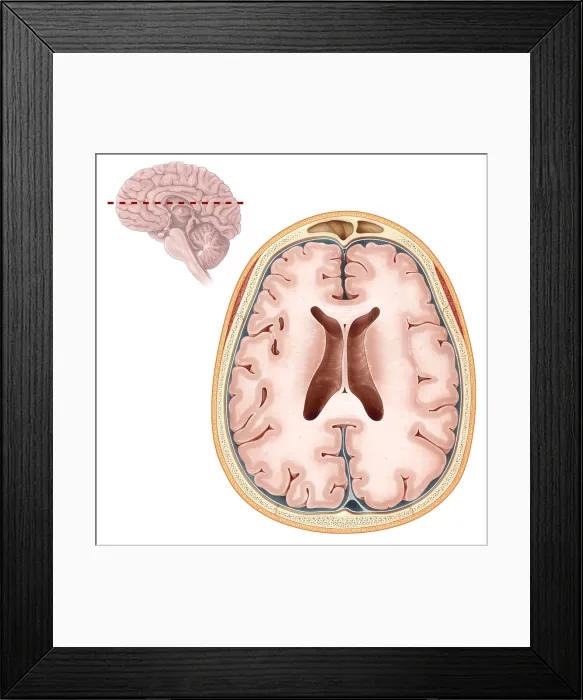 Framed Print : Brain, Transverse Section Framed Print : Brain, Transverse Section