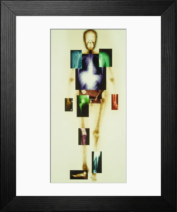 Framed Print : Composite of body Framed Print : Composite of body
