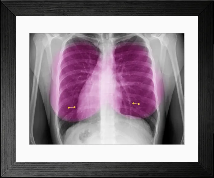 Framed Print : Nipple Piercings Framed Print : Nipple Piercings