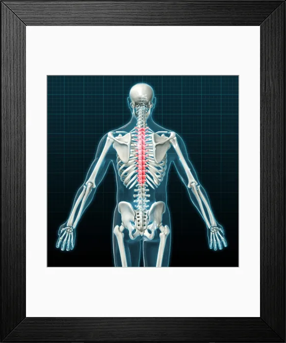 Framed Print : Thoracic Vertebrae, Illustration
