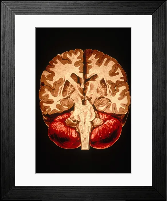 Framed Print : Brain, Coronal Section Framed Print : Brain, Coronal Section
