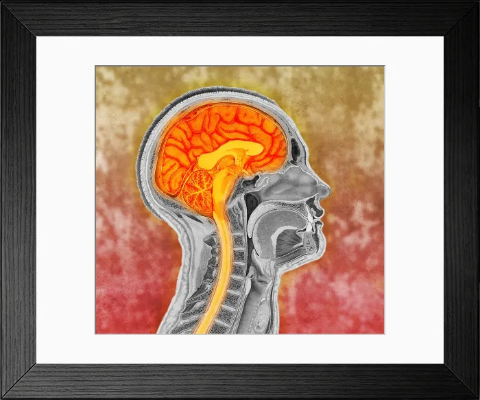 Framed Print : Human Brain, Colorized Illustration Framed Print : Human Brain, Colorized Illustration