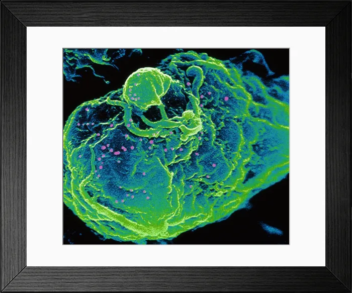 Framed Print : HIV infected T-cell Framed Print : HIV infected T-cell