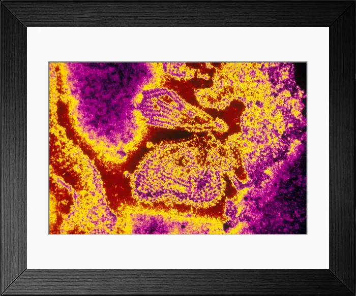 Framed Print : Mumps Virus (TEM) Framed Print : Mumps Virus (TEM)