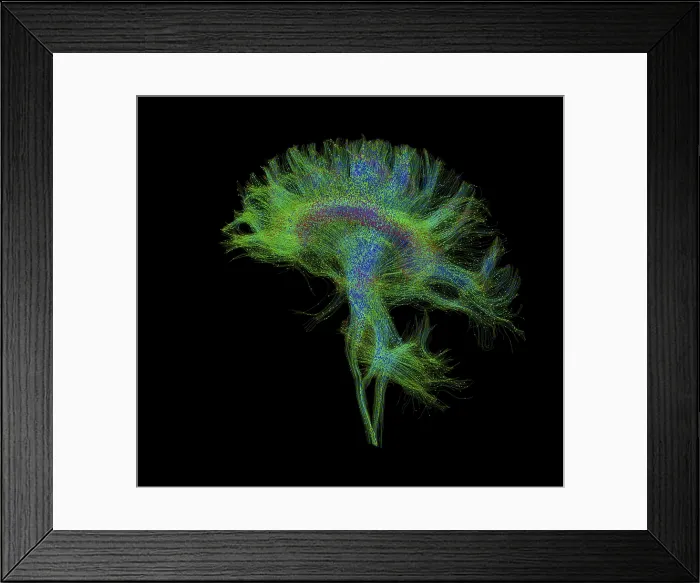 Framed Print : Brain, Fiber Tractography Image Framed Print : Brain, Fiber Tractography Image