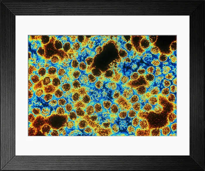Framed Print : TEM of Yellow Fever Framed Print : TEM of Yellow Fever